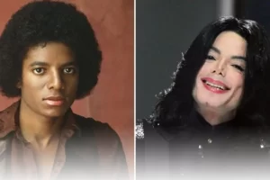 Como Michael Jackson ficou branco? Saiba a verdade e esqueça boatos michael jackson pele