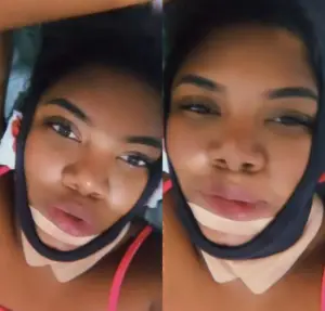 Raquel Brito fez cirurgia de retirada de papada e aparece com rosto enfaixado nas redes sociais AA1vGxqm