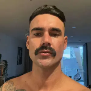 Pelo encravado muda a vida de jovem militar e o deixa acamado por um ano AA1yaWY9