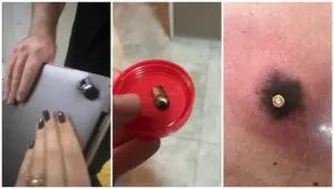 impacto-foi-amortecido-pelo-aparelho-2655335-article (1)