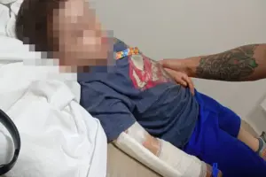 Menino autista perde dedo em acidente na escola; mãe revela risco de necrosar necroseo-criança00autista