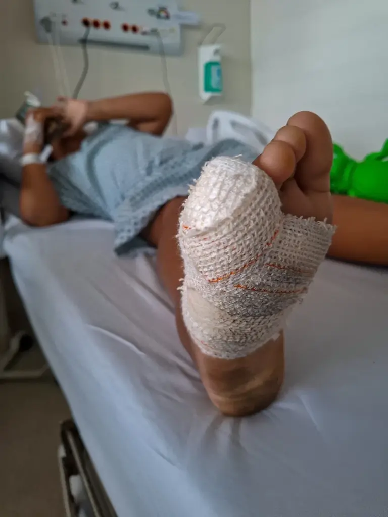 Crianças ficam mutiladas em acidente com brinquedo de condomínio no Litoral Norte da Bahia