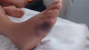 peé,f (1)
