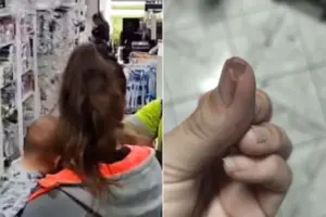Mãe Tem Parte do Dedo Arrancada Durante Assalto enquanto Amamentava Bebê - Veja vídeo mulher-foi-agredida-em-assalto-2762474-article (1)